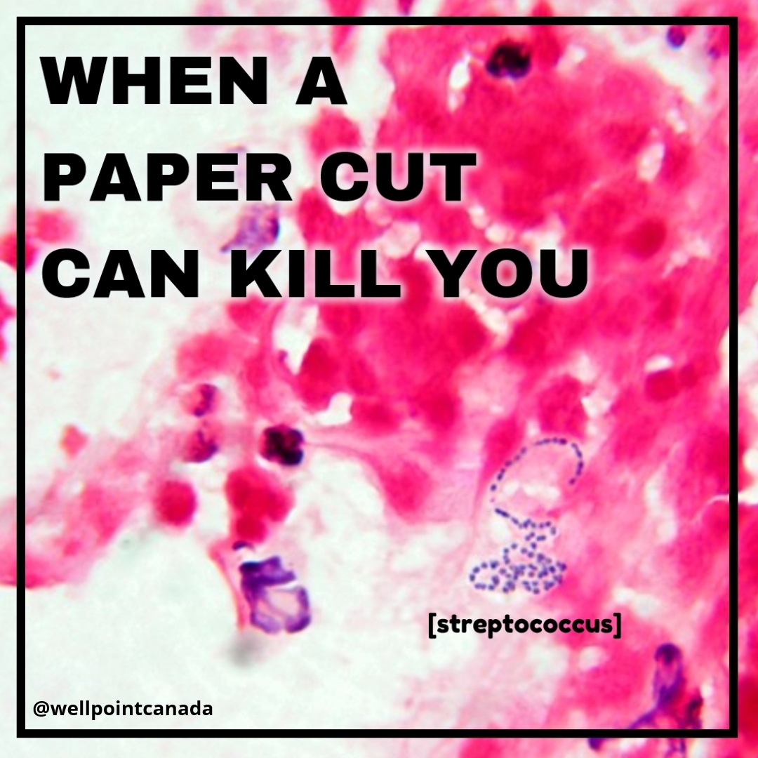 WHEN A PAPER CUT CAN KILL YOU
